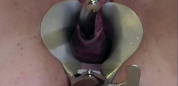  AnalSlut Urethra Play 11mm - Opening her cunt - stretching her urethra with Sounds, a Speculum and toys